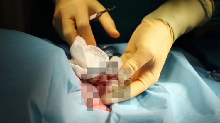 Kasus Penis Anak Terpotong Saat Sunatan di Kuansing, DPRD Riau: Kelalaian Harus Dievaluasi!