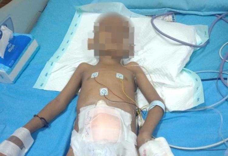 Balita Yatim Penderita Tumor Asal Indragiri Hilir Ini Butuh Uluran Tangan Dermawan