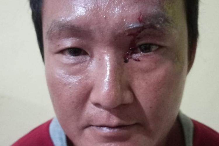 Anggota DPRD Kampar Toni Hidayat Disiram Air Cabai Saat Syukuran Bersama Warga