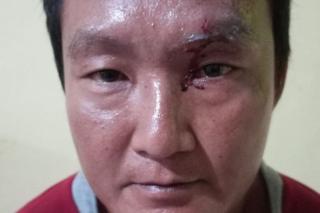 Anggota DPRD Kampar Toni Hidayat Disiram Air Cabai Saat Syukuran Bersama Warga